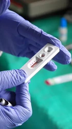 Le gouvernement a-t-il manqué le virage des changements de tests VIH ?
